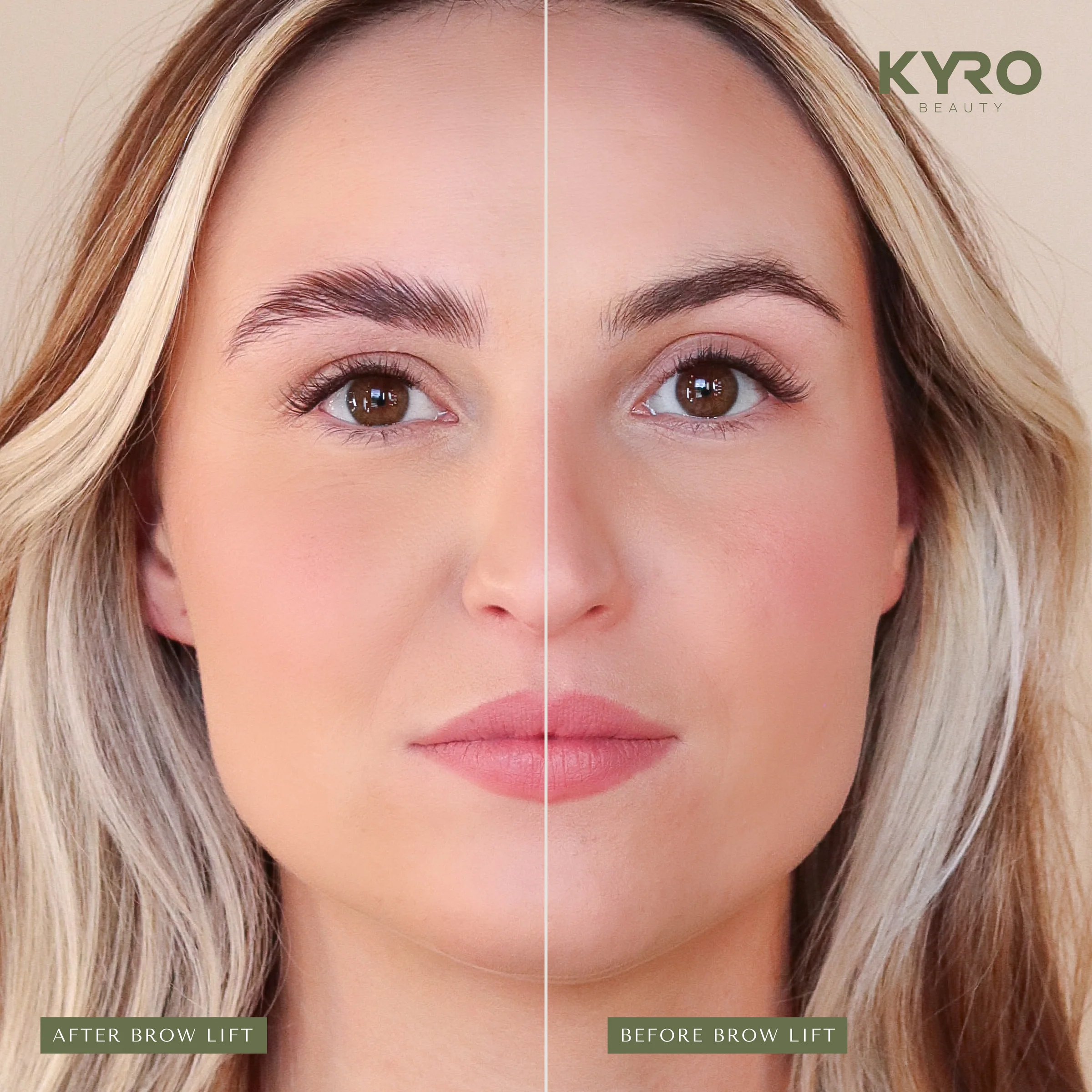 KYRO_-_Before_-_After_-_website_3_048e0493-984e-49a0-95ef-a4c5ed0030bf KYRO Before After website 3 048e0493 984e 49a0 95ef a4c5ed0030bf sve za trepavice